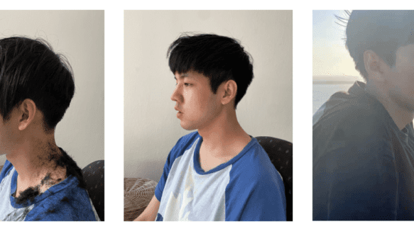 细软发 韩式修剪